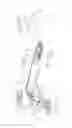 Fig. 07 - Prosthetic finger