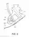 Fig. 06 - Foot prosthesis with dynamic variable keel resistance
