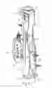 Fig. 09 - Orthopedic device