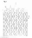Fig. 02 - Expandable vascular stent
