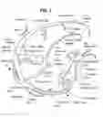 Fig. 02 - Method and system for delivering a self-expanding stent to the venous sinuses
