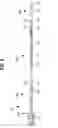 Fig. 07 - Method and system for delivering a self-expanding stent to the venous sinuses