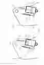 Fig. 05 - ORTHOPEDIC JOINT DEVICE
