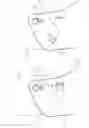Fig. 06 - ORTHOPEDIC JOINT DEVICE