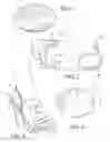 Fig. 02 - Foot prosthetic