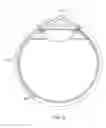 Fig. 06 - Delivery system for ocular implant