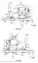Fig. 06 - HIP POSITIONER SYSTEM AND ARM ASSEMBLY