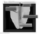 Fig. 01 - ACTIVATED MICRO-BUBBLE BASED ROOT CANAL DISINFECTION SYSTEM
