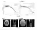 Fig. 04 - Method for preparing liposome frozen powder capable of efficiently retaining its bilayer structure