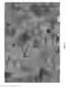 Fig. 07 - COMPOSITION AND METHODS FOR THE TREATMENT OF PERIPHERAL NERVE INJURY