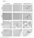 Fig. 04 - Methods relating to the diagnosis and treatment of preeclampsia comprising administration of ADAMTS13 polypeptides