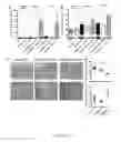 Fig. 05 - Methods relating to the diagnosis and treatment of preeclampsia comprising administration of ADAMTS13 polypeptides