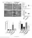 Fig. 07 - Methods relating to the diagnosis and treatment of preeclampsia comprising administration of ADAMTS13 polypeptides