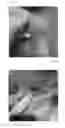 Fig. 05 - Powder compositions for generating cross-linked protein foams and methods of using thereof