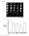 Fig. 02 - Composition for preventing or treating stroke or degenerative brain disease