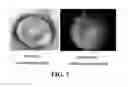 Fig. 08 - Pharmaceutical composition comprising ginseng extracts for prevention and treatment of ophthalmological diseases