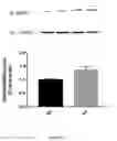 Fig. 02 - Methods for treating heart failure with a TRKB agonist