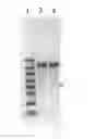 Fig. 01 - Codon-optimized CFTR MRNA