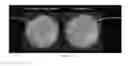 Fig. 09 - THERAPEUTIC METHODS AND COMPOSITIONS FOR SOLID DELIVERY