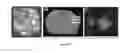 Fig. 23 - THERAPEUTIC METHODS AND COMPOSITIONS FOR SOLID DELIVERY