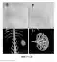 Fig. 08 - In situ solidifying complex coacervates and methods of making and using thereof