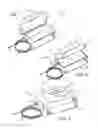 Fig. 02 - Corporeal drainage system