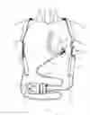 Fig. 02 - Methods and systems for upgrading ventricle assist devices