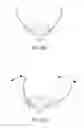 Fig. 35 - Nasal seal, mask and respiratory interface assembly