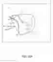 Fig. 79 - Nasal seal, mask and respiratory interface assembly