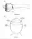 Fig. 06 - System for electrical stimulation