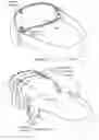 Fig. 07 - System for electrical stimulation