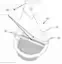 Fig. 01 - Methods and systems for lowering blood pressure through reduction of ventricle filling