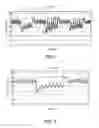 Fig. 02 - Methods and systems for lowering blood pressure through reduction of ventricle filling