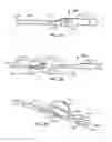 Fig. 03 - Apparatus and method for implanting an implantable device