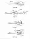 Fig. 06 - Apparatus and method for implanting an implantable device