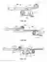 Fig. 07 - Apparatus and method for implanting an implantable device
