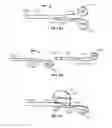Fig. 09 - Apparatus and method for implanting an implantable device