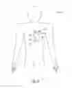Fig. 08 - Modular antitachyarrhythmia therapy system