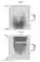Fig. 04 - Seat occupancy sensor having an array of sensors shifted from a center of a seat of a vehicle