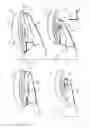 Fig. 02 - Adjustment device for a headrest of a vehicle seat