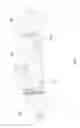 Fig. 02 - Double effect hydraulic actuating cylinder
