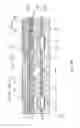 Fig. 11 - MEMS packages and methods of manufacture thereof