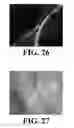 Fig. 17 - Controlled microwave assisted synthesis of functionalized silica nanoparticles
