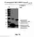 Fig. 16 - Method for preparing bacterial polysaccharide-modified recombinant fusion protein and use of the protein