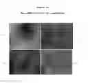 Fig. 20 - RECOMBINANT SUPER-COMPOUND INTERFERON AND USES THEREOF