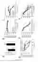 Fig. 22 - Specific interleukin-15 (IL-15) antagonist polypeptide and uses thereof for the treatment of inflammatory and auto-immune diseases