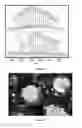 Fig. 29 - Block co-poly(metal organic nanostructures) (BCPMONs) and uses thereof
