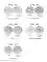 Fig. 02 - METHODS AND COMPOSITIONS FOR CELL ATTACHMENT AND CULTIVATION ON PLANAR SUBSTRATES