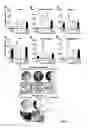 Fig. 06 - Method of making trabecular bone