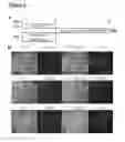 Fig. 04 - METHODS OF GENERATING NEPHRONS FROM HUMAN PLURIPOTENT STEM CELLS